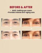 KSecret Seoul 1988 Eye Cream – Retinal Liposome 4% with Fermented Bean, 30ml - Image 2